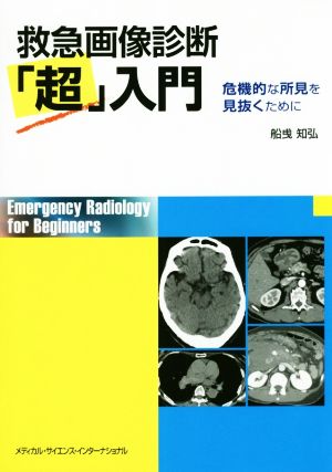 救急画像診断「超」入門 危機的な所見を見抜くために