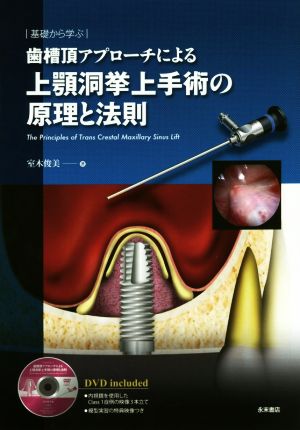 歯槽頂アプローチによる上顎洞挙上手術の原理と法則 基礎から学ぶ The Principles of Trans Crestal Maxillary Sinus Lift