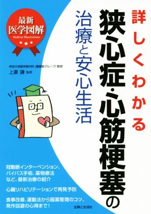 詳しくわかる狭心症・心筋梗塞の治療と安心生活 最新医学図解