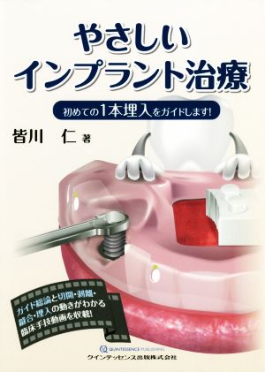 やさしいインプラント治療 初めての1本埋入をガイドします！