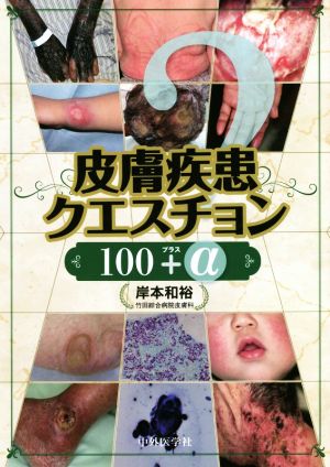 皮膚疾患クエスチョン100+α