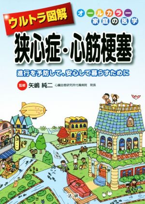 ウルトラ図解 狭心症・心筋梗塞 進行を予防して、安心して暮らすために オールカラー家庭の医学