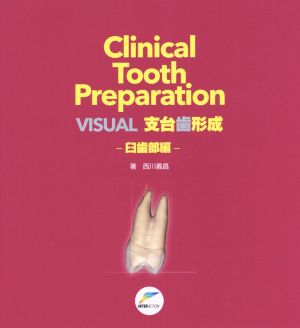 VISUAL 支台歯形成 臼歯部編 Clinical Tooth Preparation