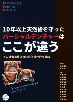 10年以上天然歯を守ったパーシャルデンチャーはここが違う その具備条件と天然歯保護の治療戦略