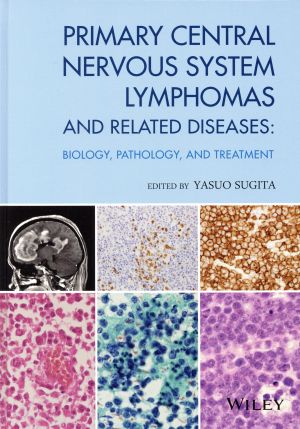 英文 PRIMARY CENTRAL NERVOUS SYSTEM LYMPHOMAS DISEASES BIOLOGY,PATHOLOGY,AND TREATMENT