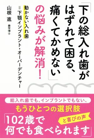 「下の総入れ歯がはずれて困る、痛くてかめない」の悩みが解消！ 動かない入れ歯=下顎インプラント・オーバーデンチャー