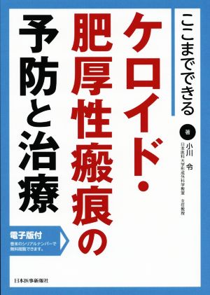 ここまでできるケロイド・肥厚性瘢痕の予防と治療