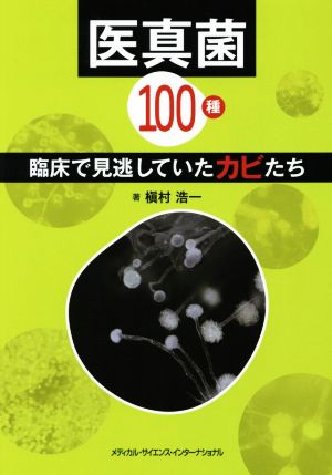 医真菌100種 臨床で見逃していたカビたち