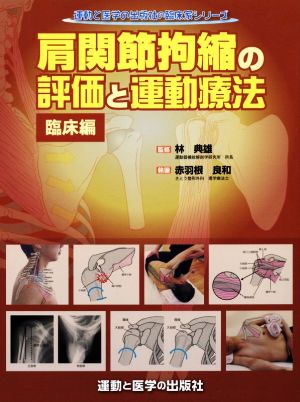 肩関節拘縮の評価と運動療法 臨床編運動と医学の出版社の臨床家シリーズ