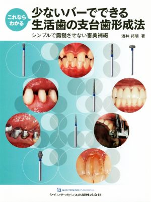 これならわかる少ないバーでできる生活歯の支台歯形成法 シンプルで露髄させない審美補綴