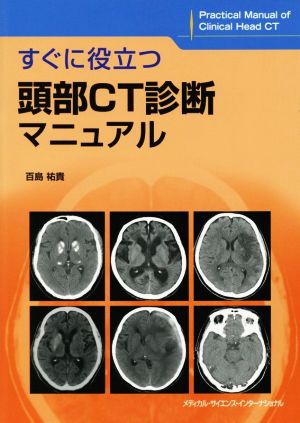 すぐに役立つ頭部CT診断マニュアル