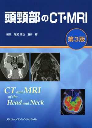 頭頸部のCT・MRI 第3版