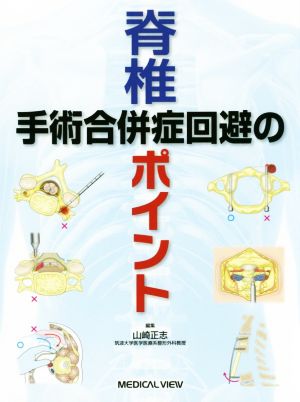 脊椎手術合併症回避のポイント