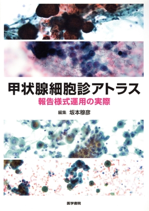 甲状腺細胞診アトラス 報告様式運用の実際