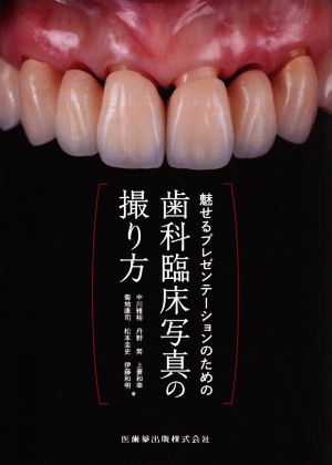 魅せるプレゼンテーションのための 歯科臨床写真の撮り方