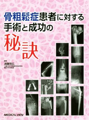 骨粗鬆症患者に対する手術と成功の秘訣