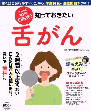 知っておきたい舌がん それって本当に口内炎？ 扶桑社ムック