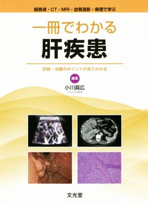 一冊でわかる肝疾患 超音波・CT・MRI・血管造影・病理で学ぶ 診断・治療のポイントが見てわかる