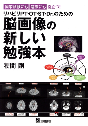 脳画像の新しい勉強本 国家試験にも臨床にも役立つ！リハビリPT・OT・ST・Dr.のための
