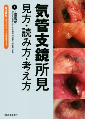 気管支鏡所見 見方・読み方・考え方