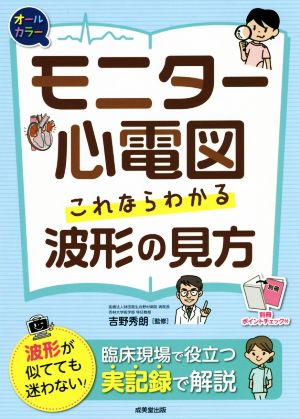 モニター心電図 これならわかる波形の見方