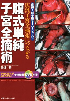 腹式単純子宮全摘術 広汎子宮全摘術につながる 産婦人科手術スーパーレッスン