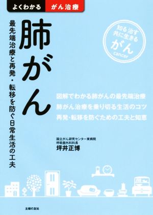 肺がん 最先端治療と再発・転移を防ぐ日常生活の工夫 よくわかるがん治療