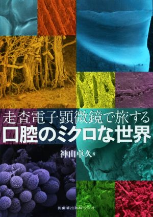 走査電子顕微鏡で旅する 口腔のミクロな世界