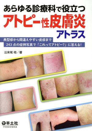 あらゆる診療科で役立つアトピー性皮膚炎アトラス 典型疹から間違えやすい皮疹まで243点の症例写真で「これってアトピー？」に答える！