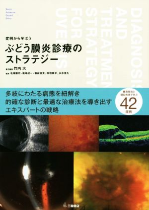 症例から学ぼう ぶどう膜炎診療のストラテジー