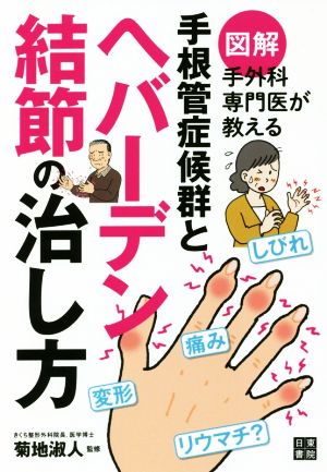 図解 手外科専門医が教える手根管症候群とヘバーデン結節の治し方