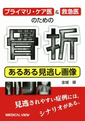 骨折 あるある見逃し画像 プライマリ・ケア医&救急医のための