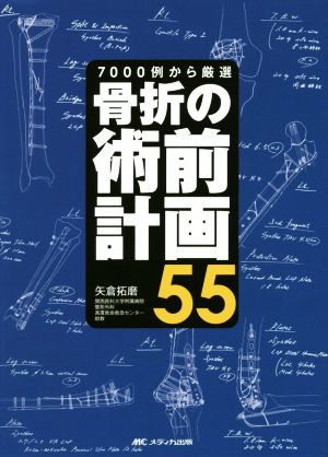 骨折の術前計画55 7000例から厳選