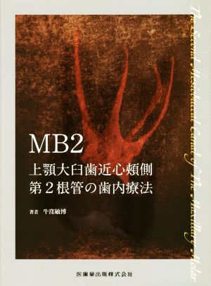 MB2 上顎大臼歯近心頬側第2根管の歯内療法