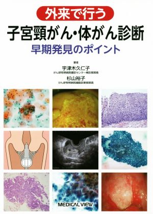 外来で行う子宮頸がん・体がん診断 早期発見のポイント