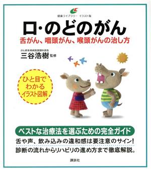 口・のどのがん 舌がん、咽頭がん、喉頭がんの治し方 健康ライブラリー イラスト版