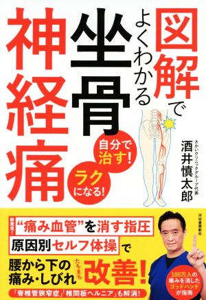 図解でよくわかる坐骨神経痛 自分で治す！ラクになる！