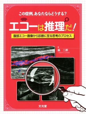 エコーは推理だ！ 腹部エコー画像から診断に至る思考のプロセス