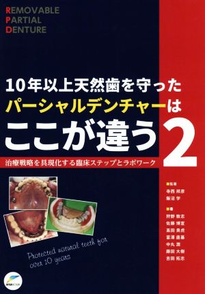 10年以上天然歯を守ったパーシャルデンチャーはここが違う(2) 治療戦略を具現化する臨床ステップとラボワーク