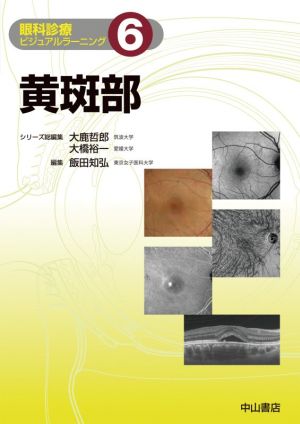 黄斑部眼科診療ビジュアルラーニング6