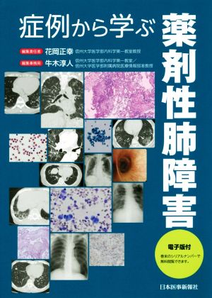 症例から学ぶ薬剤性肺障害