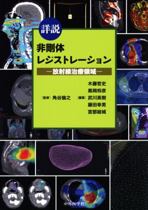 詳説 非剛体レジストレーション 放射線治療領域