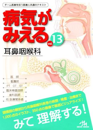 病気がみえる 耳鼻咽喉科(vol.13)