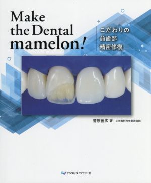 Make the Dental mamelon！ こだわりの前歯部精密修復