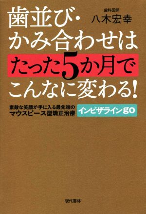 歯並び・かみ合わせはたった5か月でこんなに変わる！ 素敵な笑顔が手に入る最先端のマウスピース型矯正治療インビザラインgo