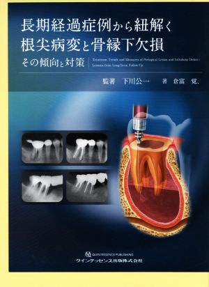 長期経過症例から紐解く根尖病変と骨縁下欠損 その傾向と対策