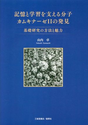 記憶と学習を支える分子カムキナーゼⅡの発見 基礎研究の方法と魅力