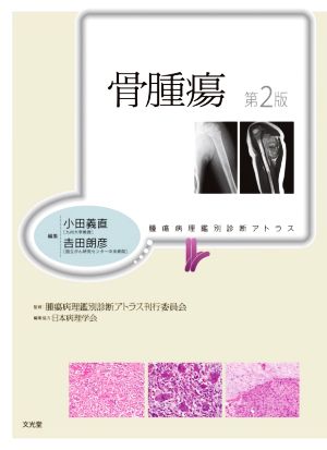 骨腫瘍 第2版 腫瘍病理鑑別診断アトラス 新品本・書籍 | ブックオフ 