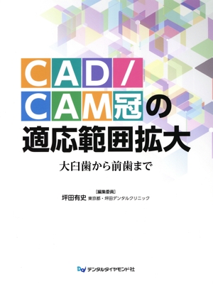 CAD/CAM冠の適応範囲拡大 大臼歯から前歯まで