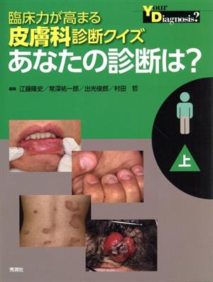 臨床力が高まる皮膚科診断クイズ あなたの診断は？(上)